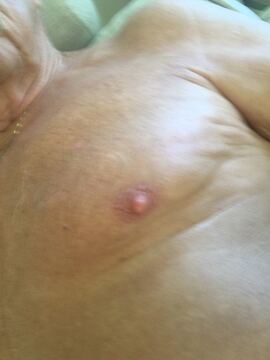 Visex